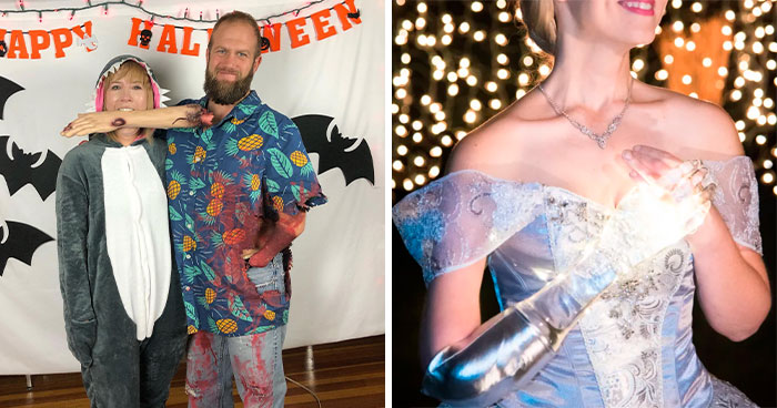40 Personas con discapacidades que triunfaron en Halloween gracias a su sentido del humor (nuevas fotos)
