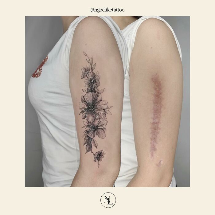 50 Times People Asked To Cover Up Their Scars, And This Tattoo Artist Nailed It (New Pics)