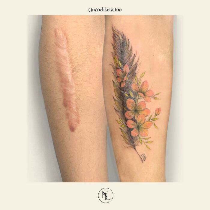 50 Times People Asked To Cover Up Their Scars, And This Tattoo Artist Nailed It (New Pics)