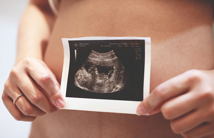 Esta joven creyó que tenía apendicitis, se dirigió a un hospital y terminó dando a luz a una bebé