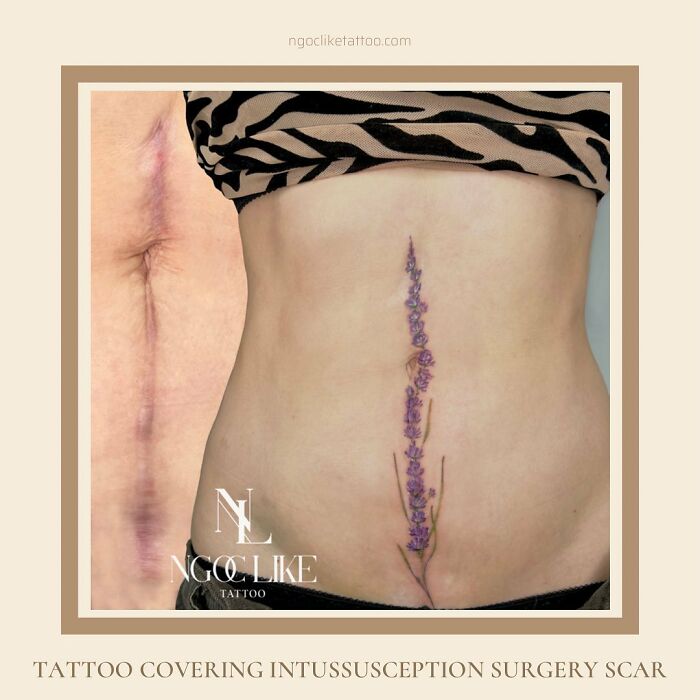 50 Times People Asked To Cover Up Their Scars, And This Tattoo Artist Nailed It (New Pics)