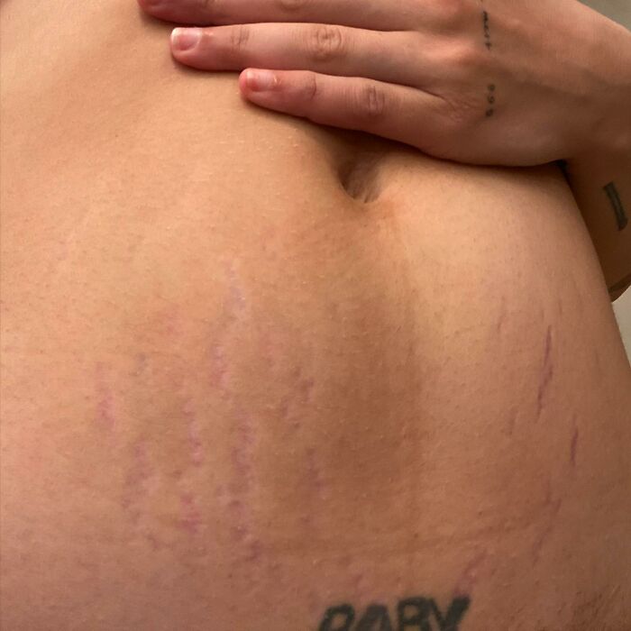 Cuando Halsey compartió esta instantánea de sus estrías postparto