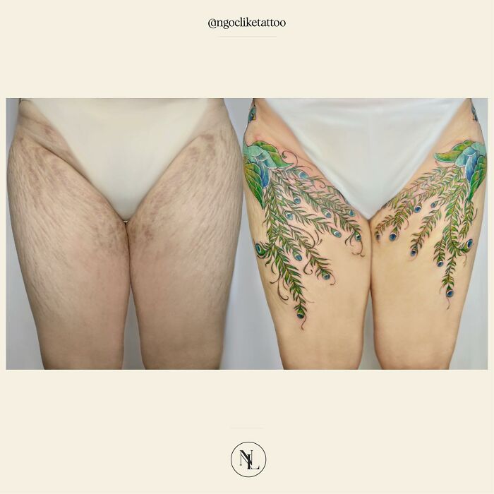 50 Times People Asked To Cover Up Their Scars, And This Tattoo Artist Nailed It (New Pics)