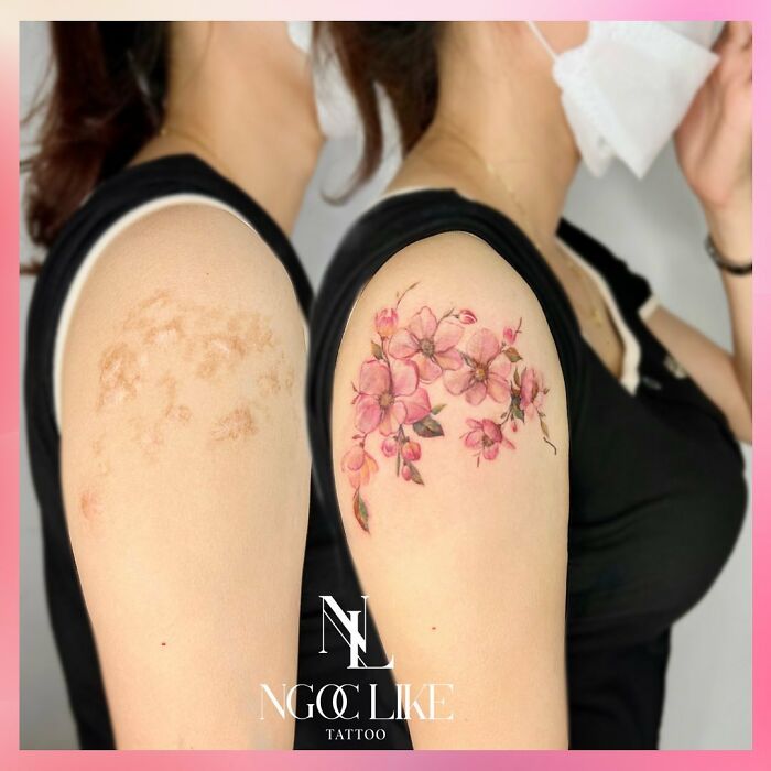 50 Times People Asked To Cover Up Their Scars, And This Tattoo Artist Nailed It (New Pics)