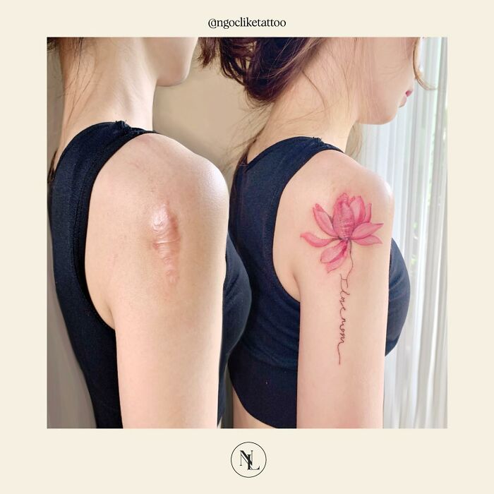 50 Times People Asked To Cover Up Their Scars, And This Tattoo Artist Nailed It (New Pics)
