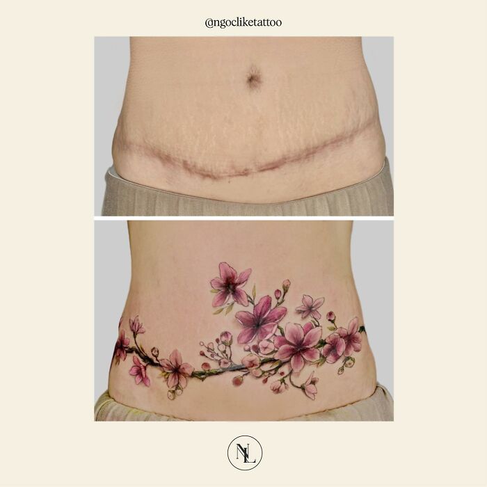 50 Times People Asked To Cover Up Their Scars, And This Tattoo Artist Nailed It (New Pics)