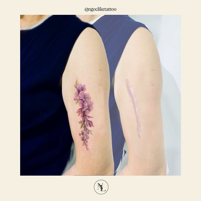 50 Times People Asked To Cover Up Their Scars, And This Tattoo Artist Nailed It (New Pics)