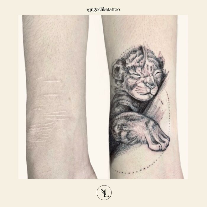 50 Times People Asked To Cover Up Their Scars, And This Tattoo Artist Nailed It (New Pics)