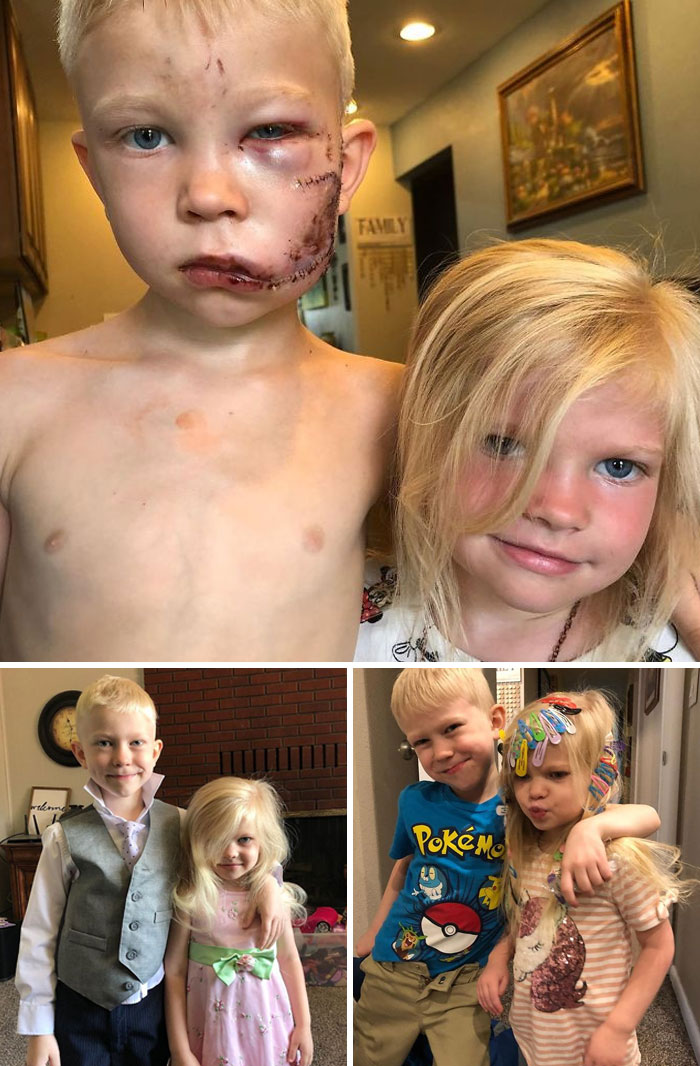 Un niño de 6 años protegió a su hermana pequeña del ataque de un perro. Dijo: "Si alguien tiene que morir, he de ser yo. Soy el hermano mayor"