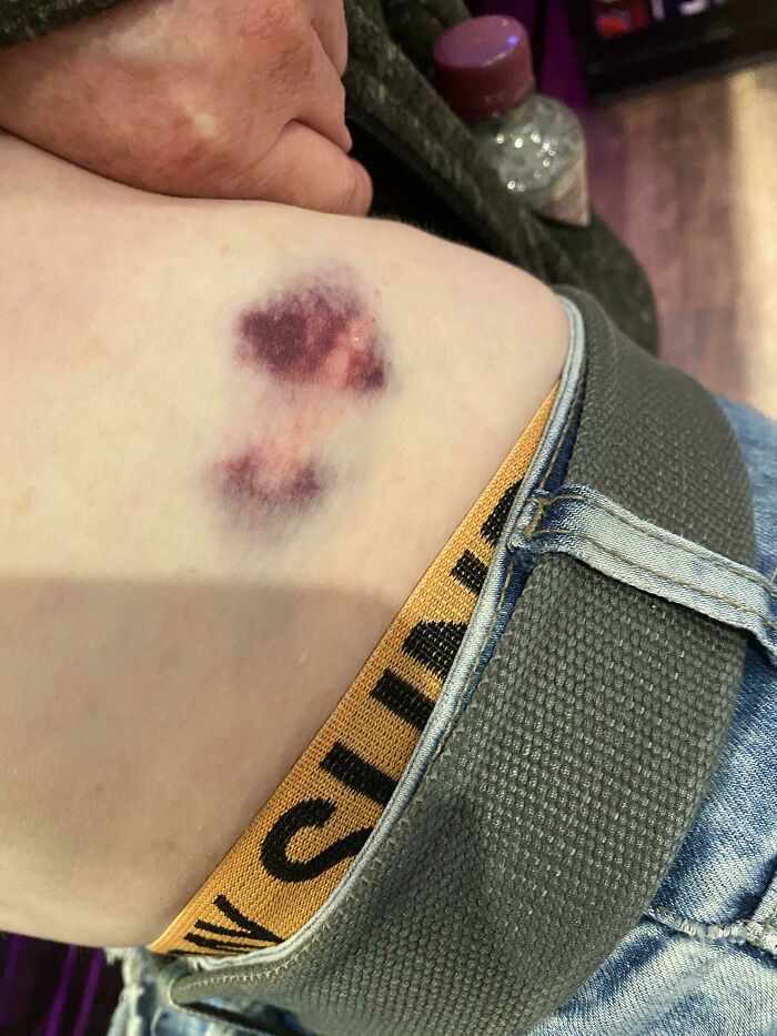 Mi amigo entró en estado de fuga y vagó por el campo a las 3 de la madrugada