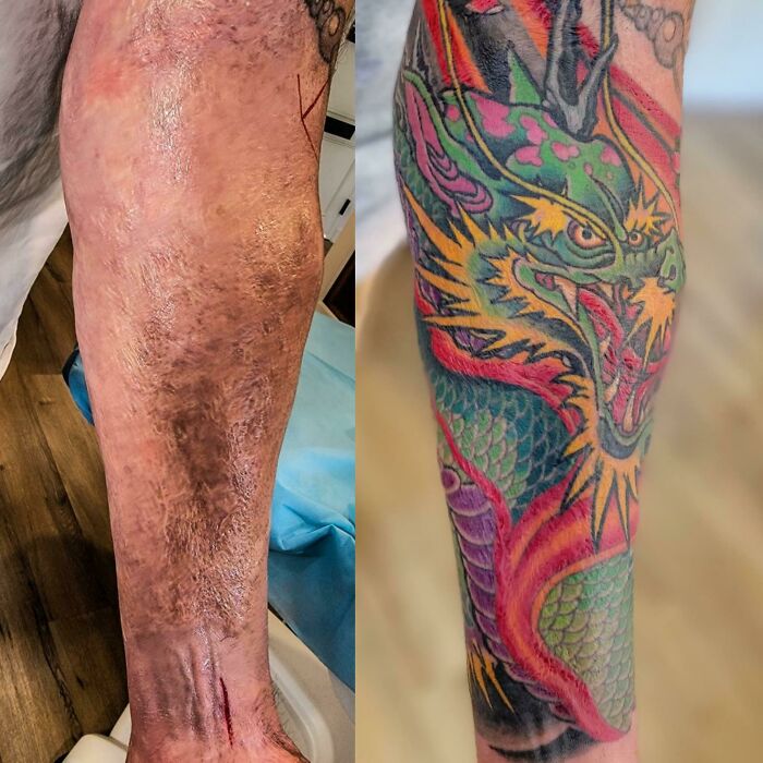 He cubierto algunas cicatrices de quemaduras de tercer grado con un dragón de fuego de Adam Sky, Morningstar Tattoo, Belmont, California