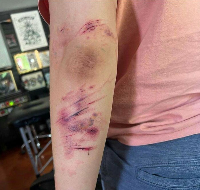 Seguro que estos tatuajes de raspones deben estar aquí