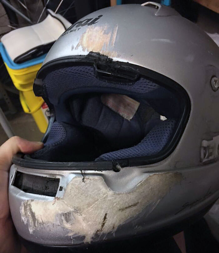 Por eso debes llevar casco completo. Mi amigo fue atropellado por alguien que se saltó un semáforo en rojo. Si hubiera llevado un casco sencillo, no tendría mandíbula inferior