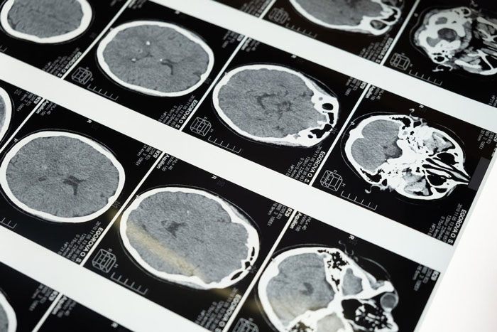 25 Datos científicos tan espeluznantes que ojalá fueran mentira