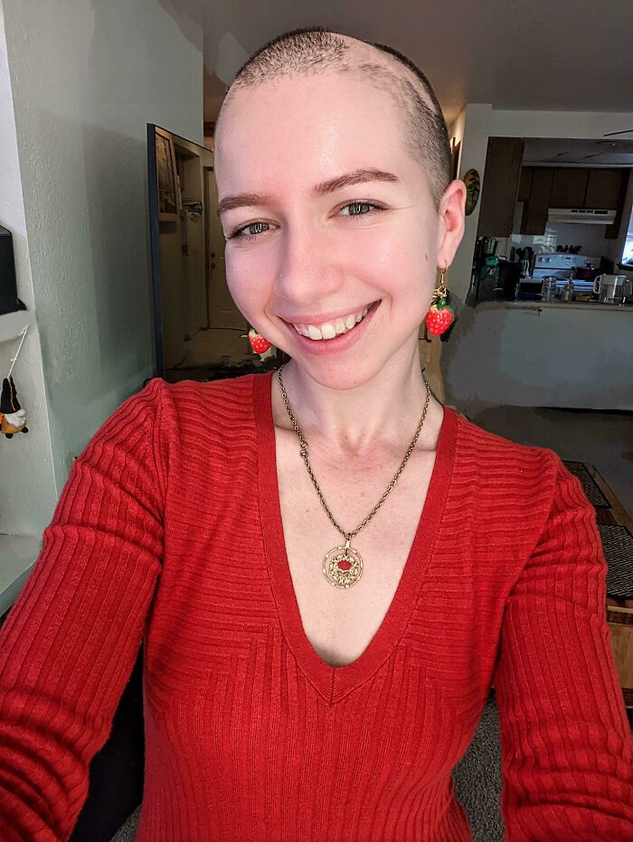 Ya no tomo el medicamento contra la alopecia aprobado por la FDA debido a sus graves efectos secundarios. He decidido aceptar plenamente el hecho de que voy a ser una princesa con parches en la cabeza y estoy bien con eso