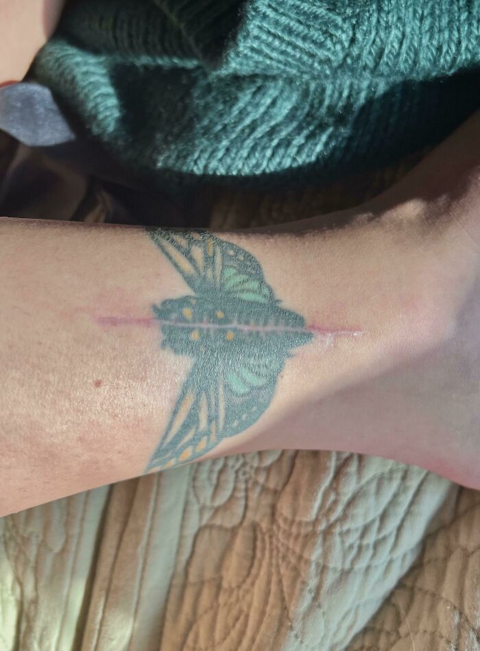 Esta cirugía requirió una incisión justo en el centro de mi tatuaje