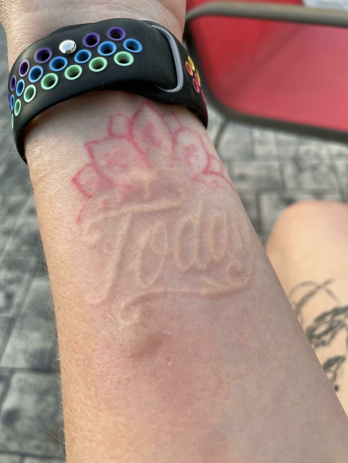 Me picó un mosquito junto a un tatuaje y las letras se hincharon en 3D