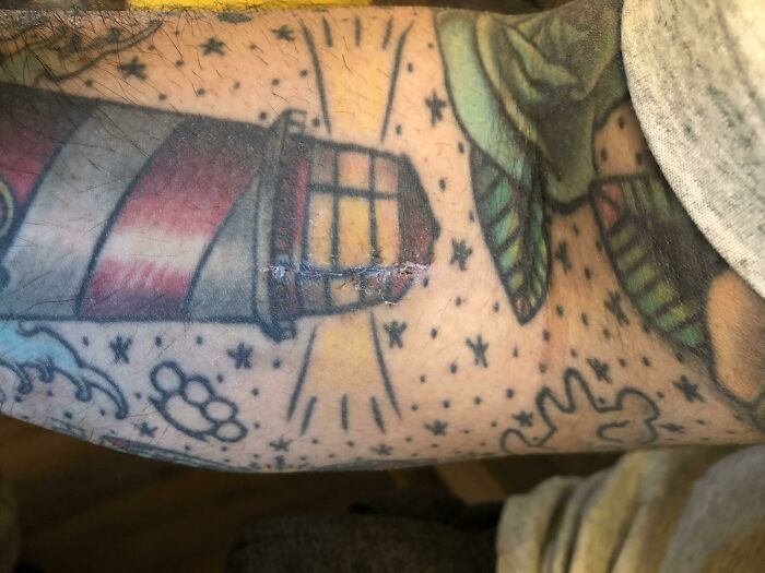 La forma en que el cirujano hizo esta incisión en el brazo de mi novio para mantener su tatuaje lo más inalterado posible después de que se desgarrara el bíceps