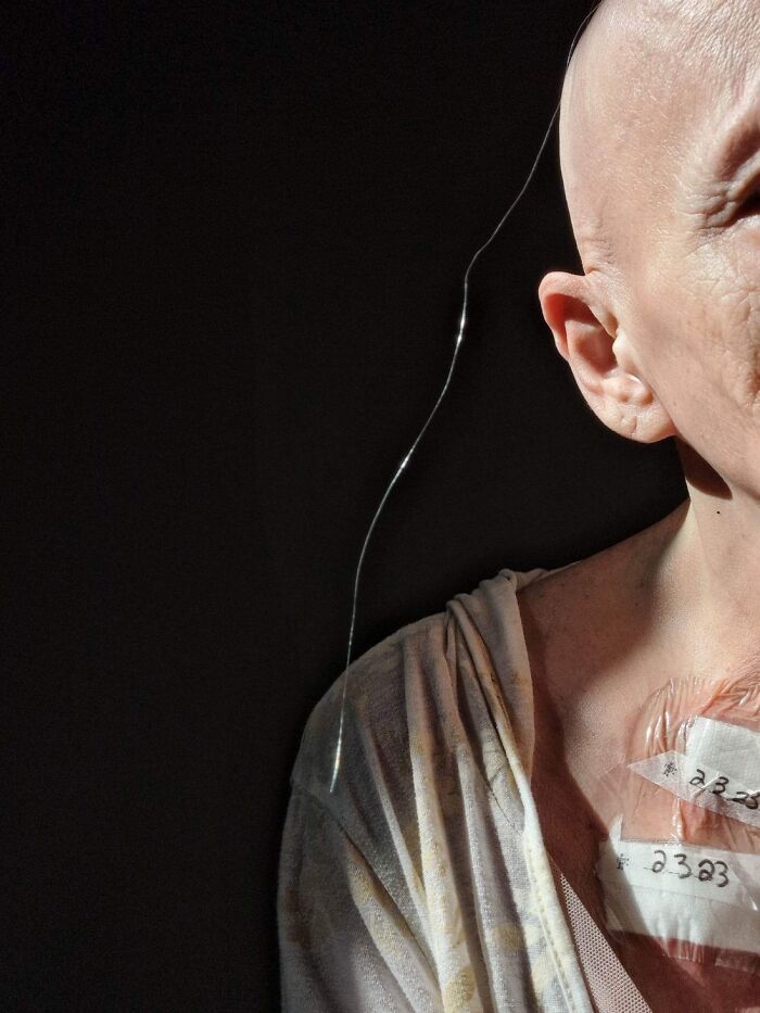 El último pelo de mi madre. Autorretrato. A esta increíble mujer le quedan 4 meses de quimioterapia