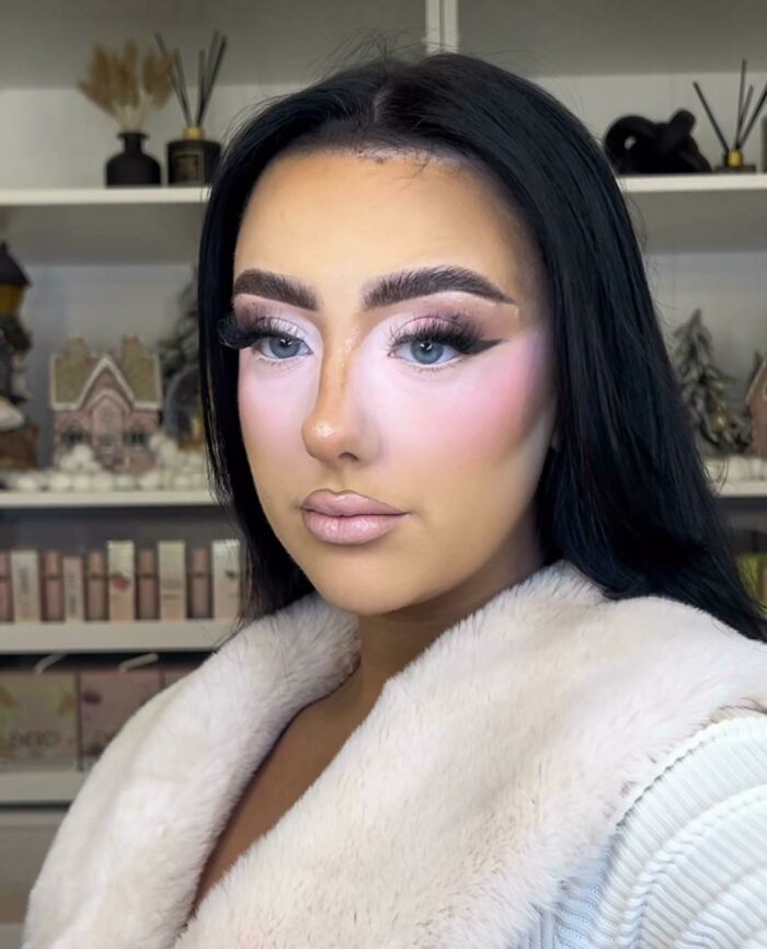 Ojeras rosadas 