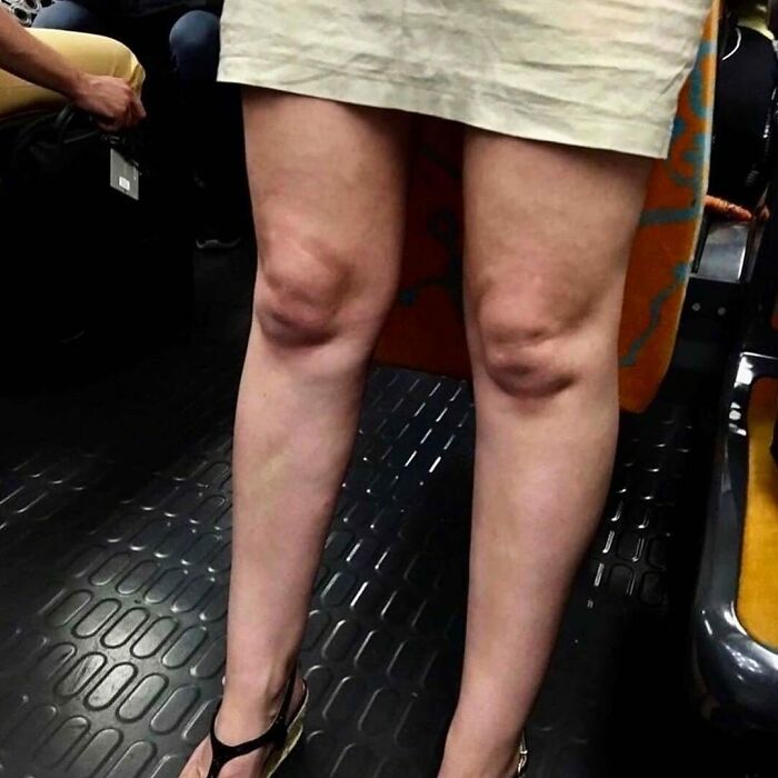 These Instagram Pages Are Dedicated To Bizarre Images That Are Not Pleasant To The Eye, Here Are 50 Of The Worst