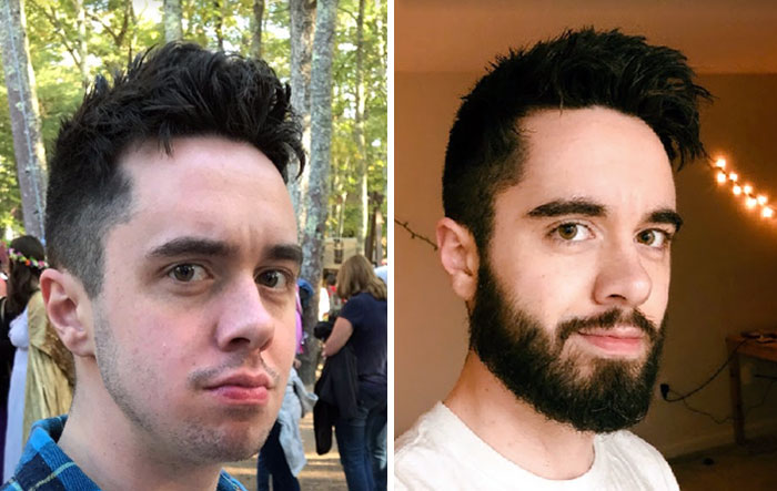 No volveré a afeitarme. Antes vs. después