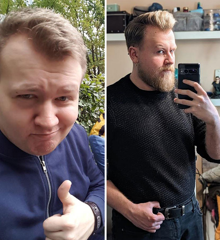 Yo hace exactamente 5 años vs. Yo hoy. Me dejé barba, perdí peso y gané confianza. La decisión de dejarme crecer la barba hace 2 años fue una gran victoria