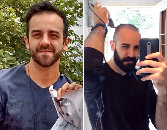 Hoy después de mucho tiempo de inseguridad con mi caída de pelo, decidí cortármelo todo y dejarme crecer una barba más gruesa. Lo recomiendo a cualquiera que necesite un aumento de confianza
