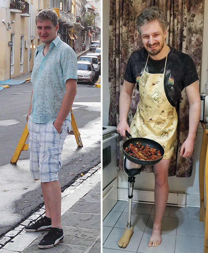 De 2014 a 2020. Perdí una pierna pero adquirí una barba. Empiezo a sentirme más positivo y optimista que nunca