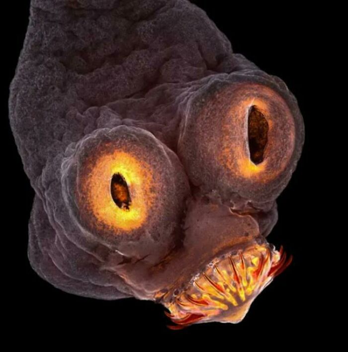 Imagen microscópica de una cabeza de gusano cinta