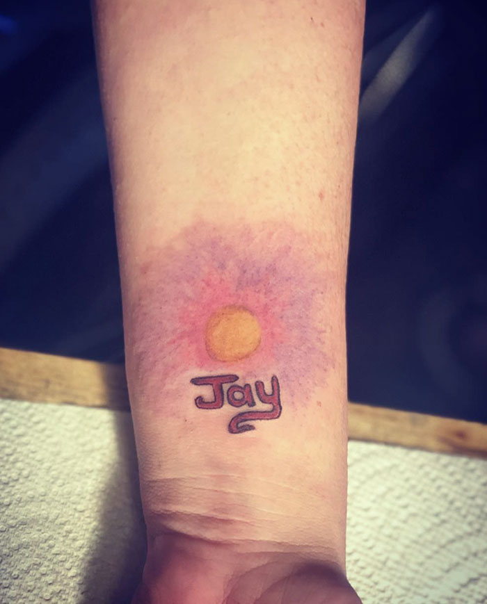 Se supone que es el sol, pero parece una enfermedad de la piel