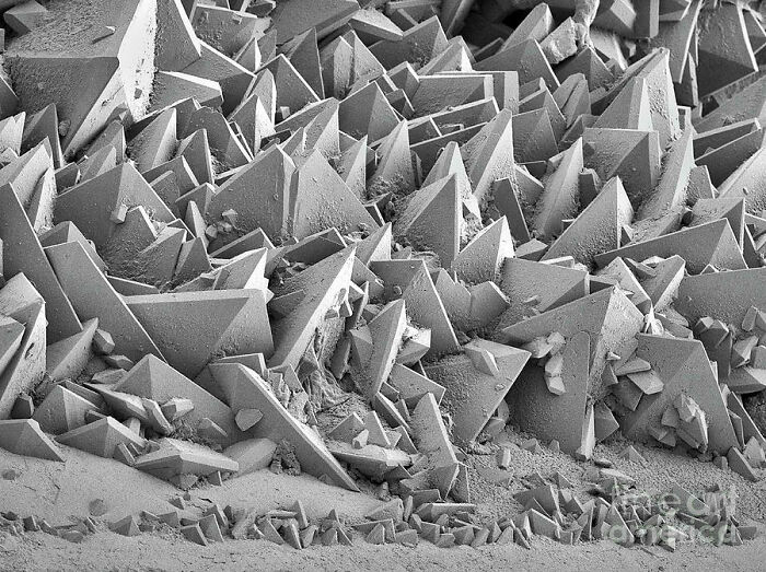 La superficie de una piedra en el riñón bajo un microscopio de electrones