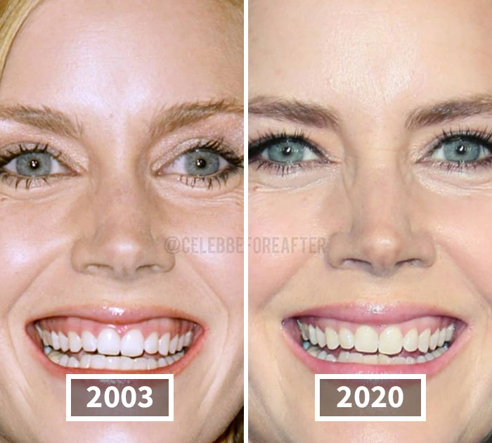 Amy Adams