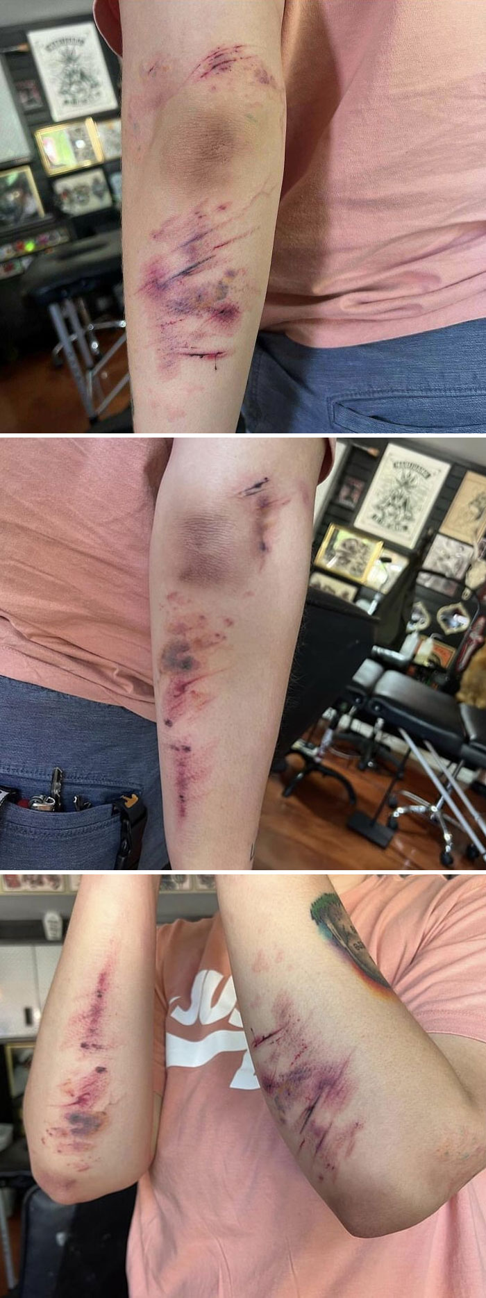 Creo que estos tatuajes de magulladuras deben estar aquí