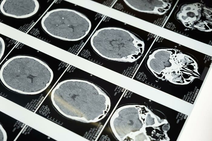 "¿Qué pasó con la persona más inteligente de tu escuela?": 20 respuestas