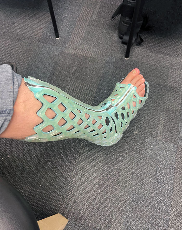 "Escayola" impermeable que me han puesto en el tobillo