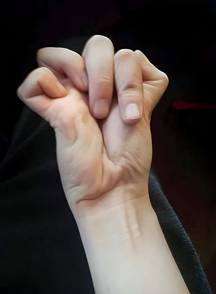Un calambre en mi mano