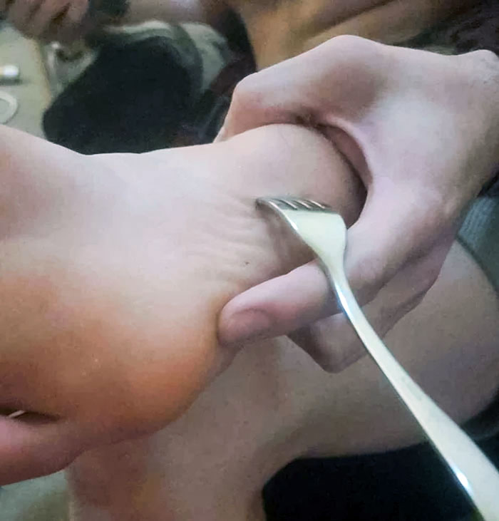 Se me ha caido un tenedor y lo he pisado sin querer