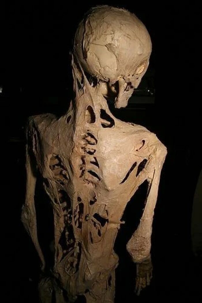 33 Datos curiosos y algunos tan morbosos que no son aptos para cardíacos