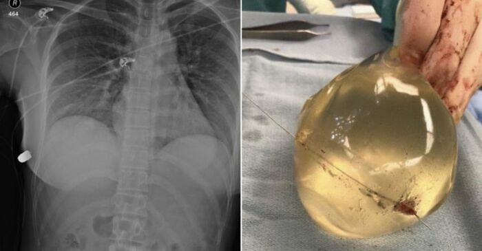 33 Datos curiosos y algunos tan morbosos que no son aptos para cardíacos