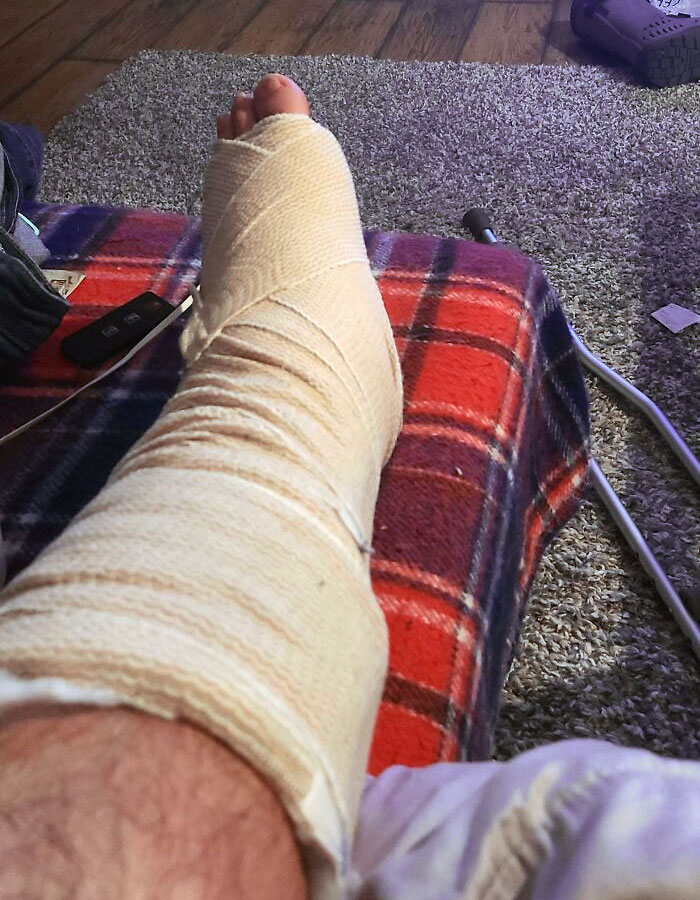 Feliz año nuevo, cuidado al pisar hielo. Me lo he roto por 3 sitios, y vivo solo en el bosque