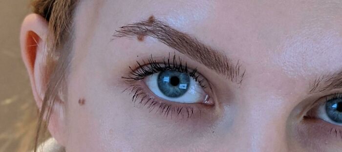 Mis lunares parecen un piercing en la ceja