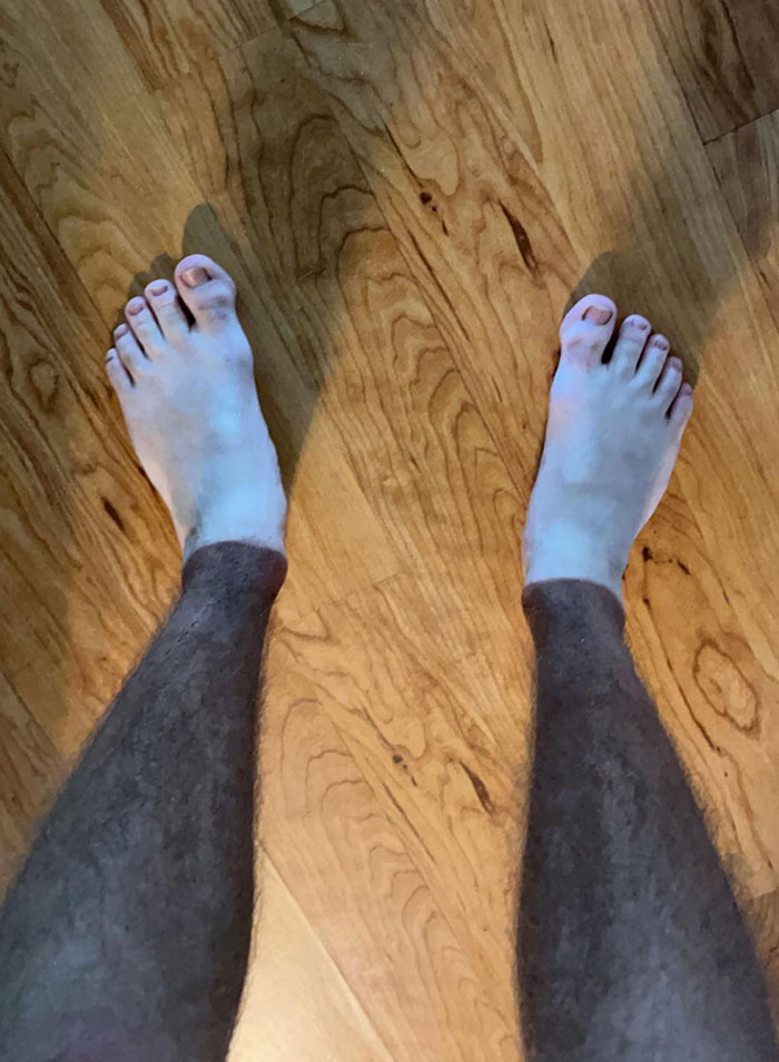 La marca del bronceado hace que parezca que llevo leggings