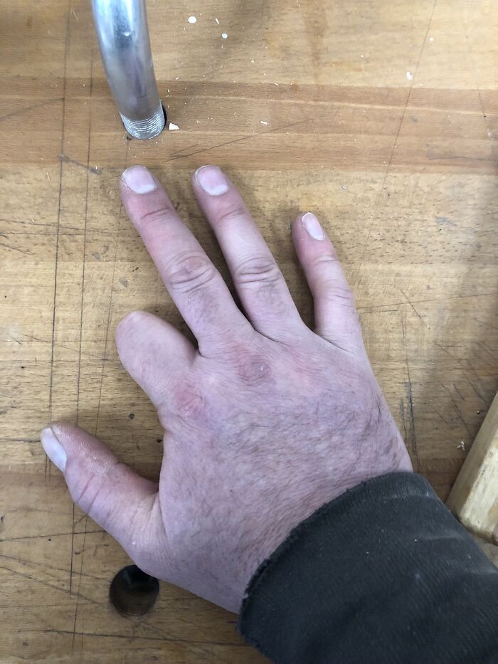 Como carpintero, hay que cuidar la seguridad. Así se vería mi mano si me cortara un dedo