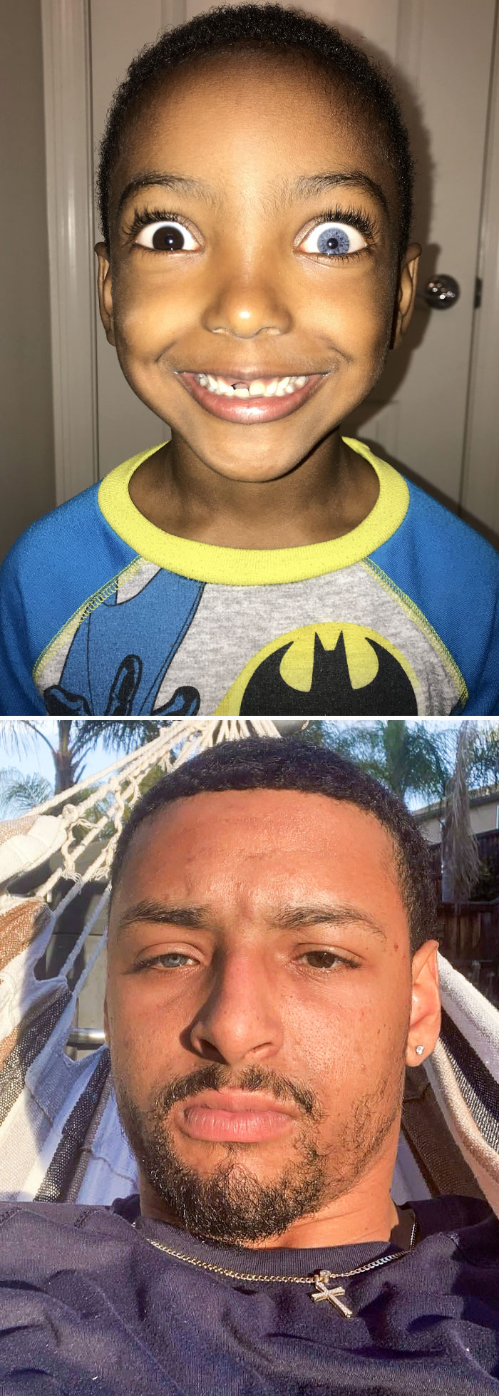 Mi hermanito y yo, los dos tenemos heterocromía