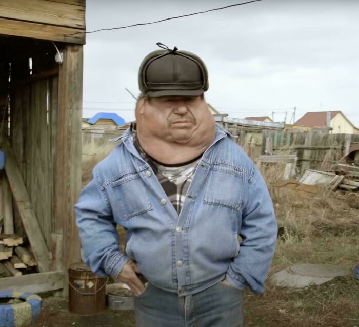 Hombre con envenenamiento por radiación, zona de Chelyabinsk, Rusia