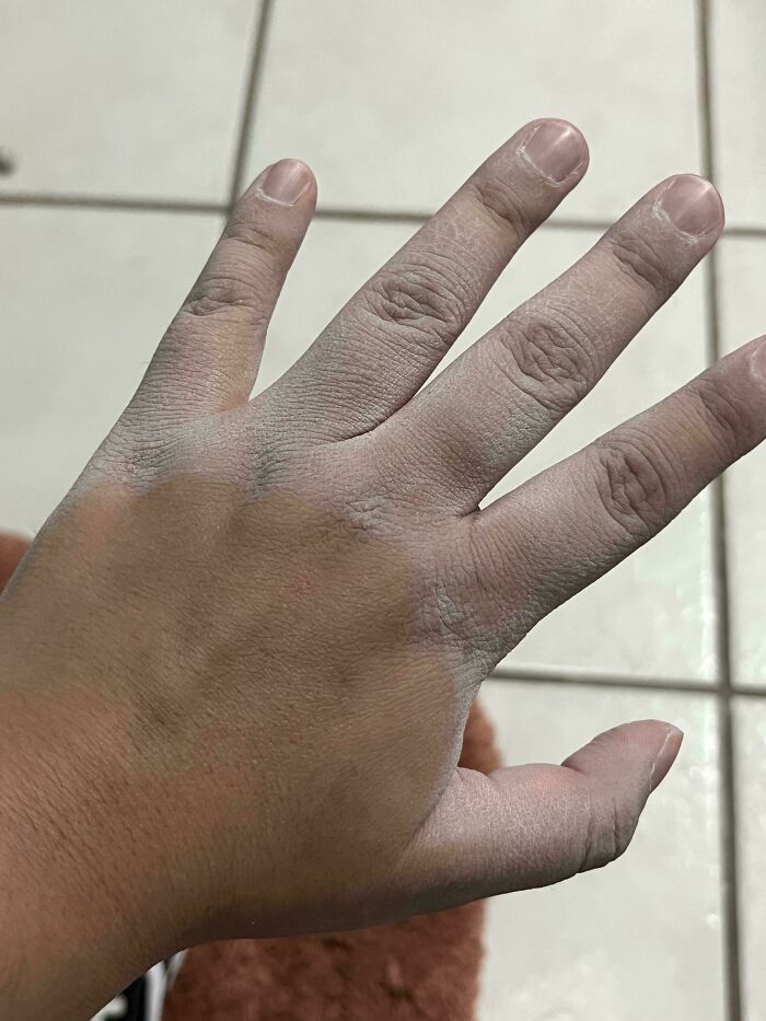 Esto me pasa cada vez que entro en contacto con agua caliente
