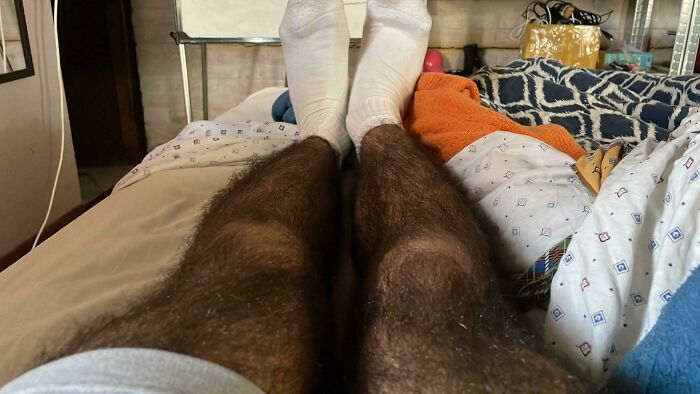Mis piernas peludas