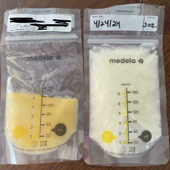 Diferencia de color en leche materna 3 días tras el parto vs 8 semanas tras el parto