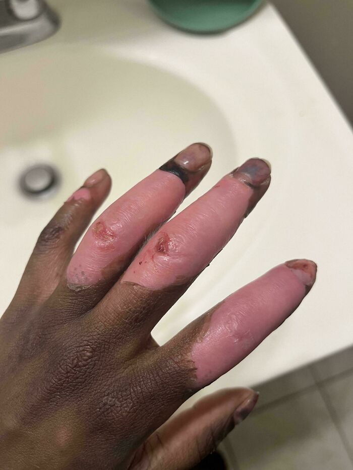 Debajo de mi piel soy rosa